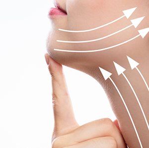 Neck Lift