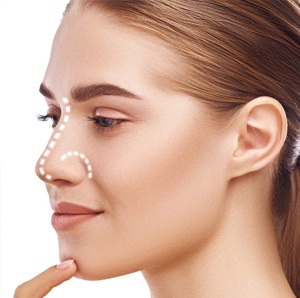 Rhinoplasty