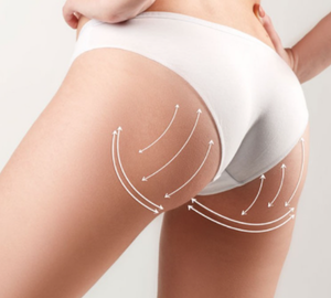 Brazilian Butt Lift Surgery in Türkiye: Everything You Need to Know