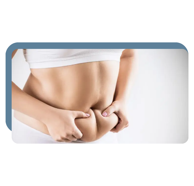 how long do tummy tuck results