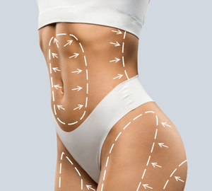 Mommy Makeover Cost in Turkey 2026: Full Price Guide