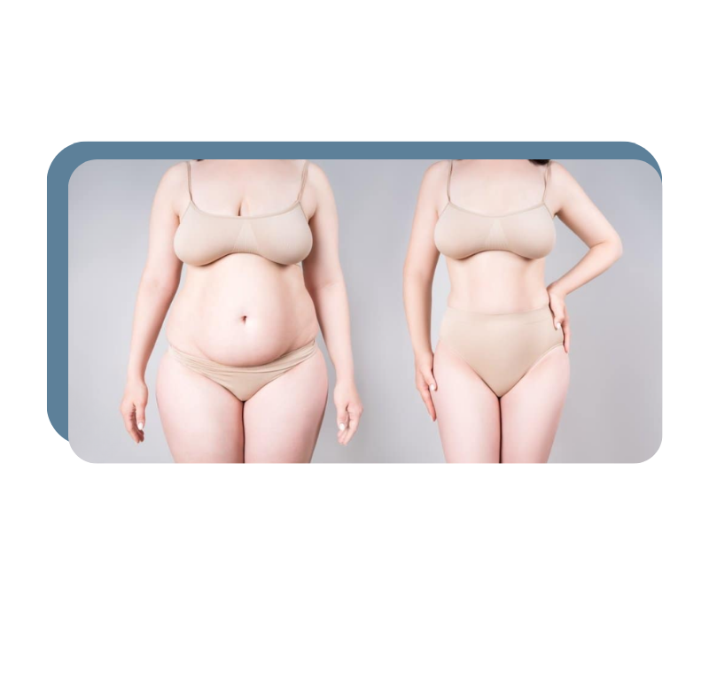 J-Plasma vs Vaser vs Traditional Liposuction
