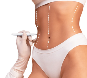 What Is Included in Tummy Tuck Packages in Turkey?