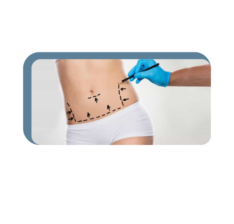 tummy tuck packages in Turkey
